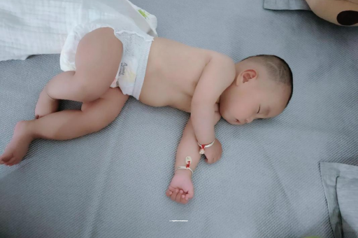 枝江六个月宝宝眼睛散光